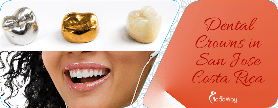 Dental Crowns in San Jose, Costa Rica